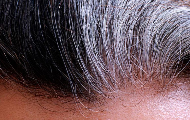 3 Posibles causas por las que tu cabello se puede poner canoso antes de tiempo