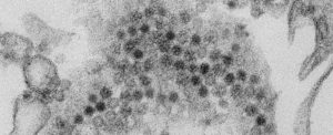 Nuevo tipo de virus descubierto en Japón