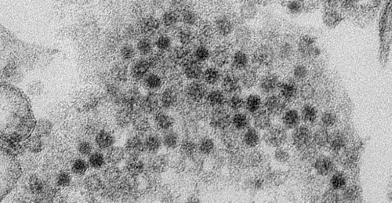 Nuevo tipo de virus descubierto en Japón