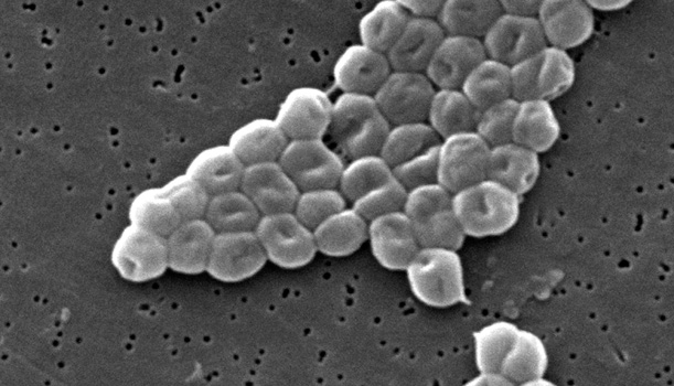 Las 7 bacterias más letales del mundo
