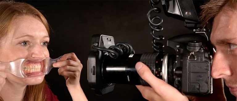 Las mejores cámaras fotográficas para odontología