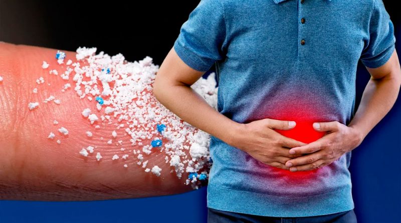 Relación entre los microplásticos y la enfermedad Inflamatoria intestinal