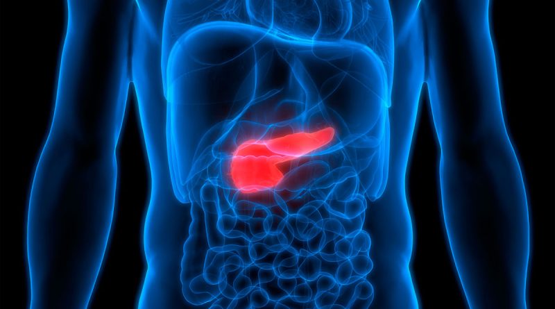 Qué es el cáncer páncreas y cuáles son sus síntomas