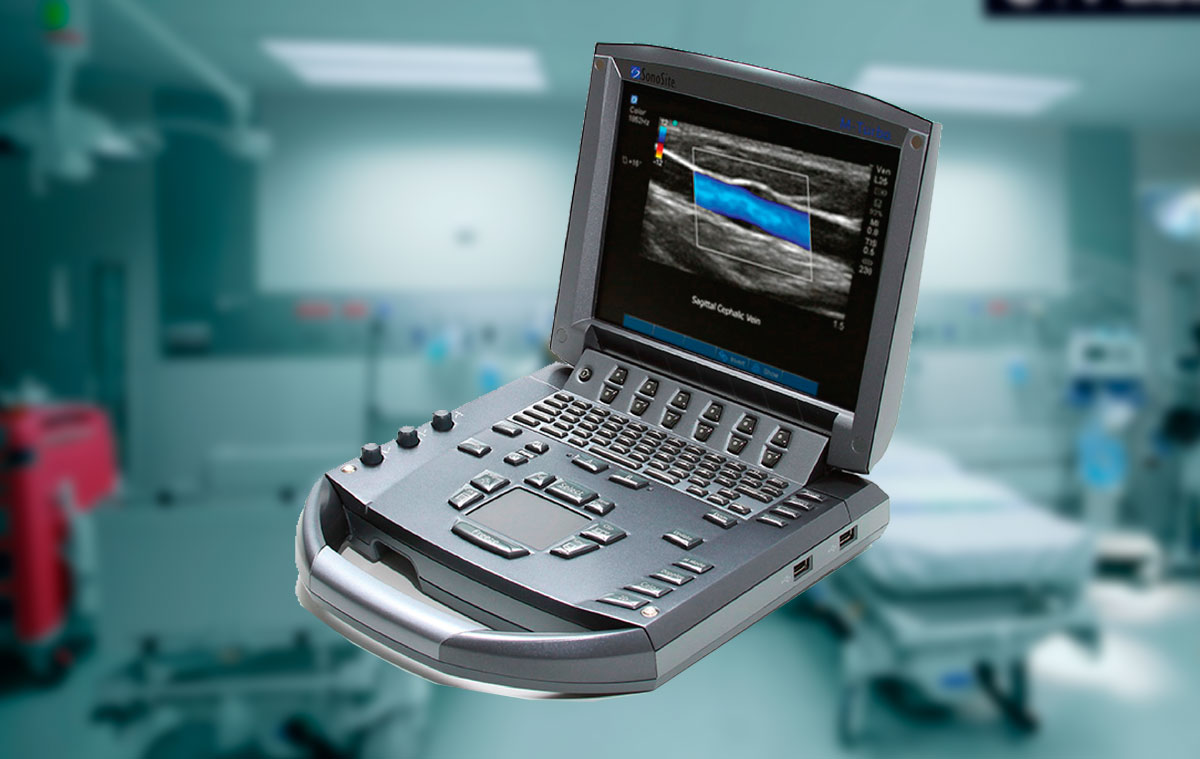 Las mejores marcas de ultrasonido portátil para médicos
