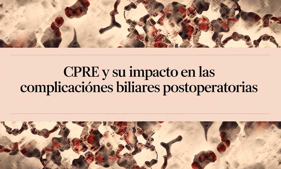 CPRE y su Impacto en las Complicaciones Biliares Postoperatorias